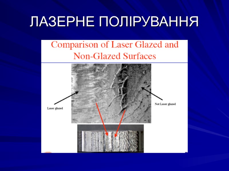 ЛАЗЕРНЕ ПОЛІРУВАННЯ